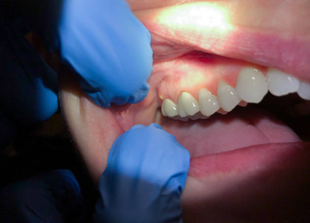 Best Orthodontic Emergency Dentist in Cahokia, IL
